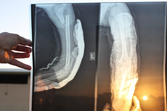 Sowas braucht kein Mensch! Schon gar nicht bei Kids!